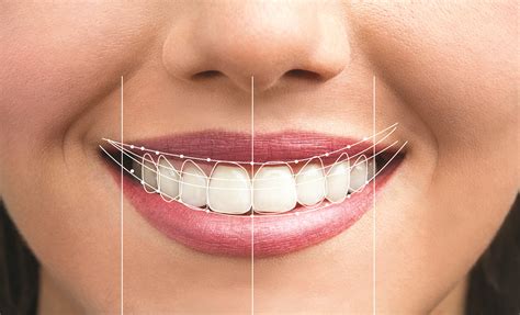 Houston's Smile Magic: Redefining the Dental Experience